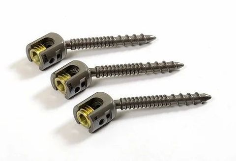 Pedicle Screw Manufacturing Insights: Innovations Shaping Modern Implants